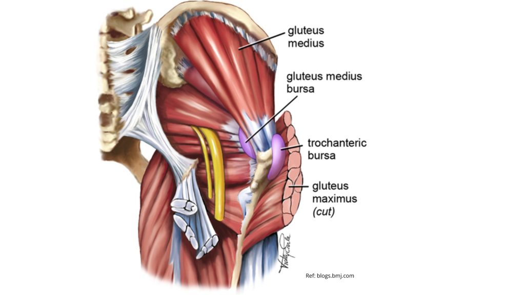 What A Pain In The Hip