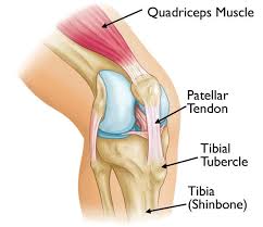 Osgood schlatter - five dock