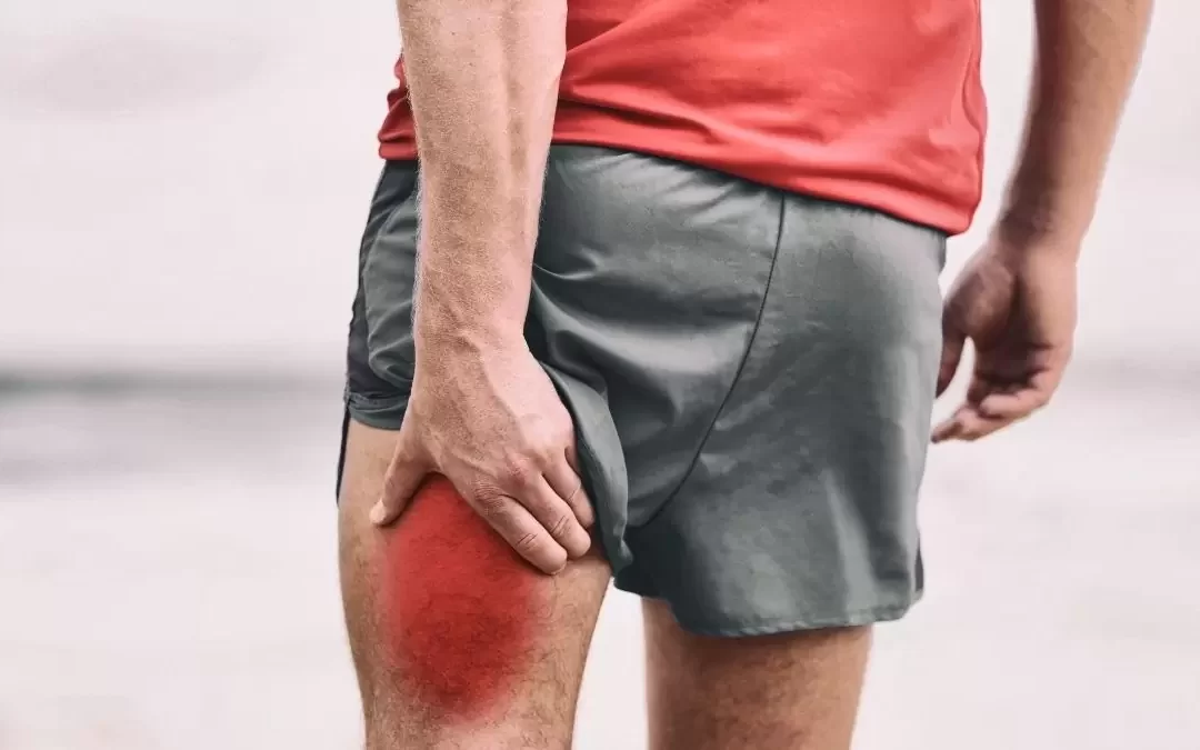 Hamstring tears