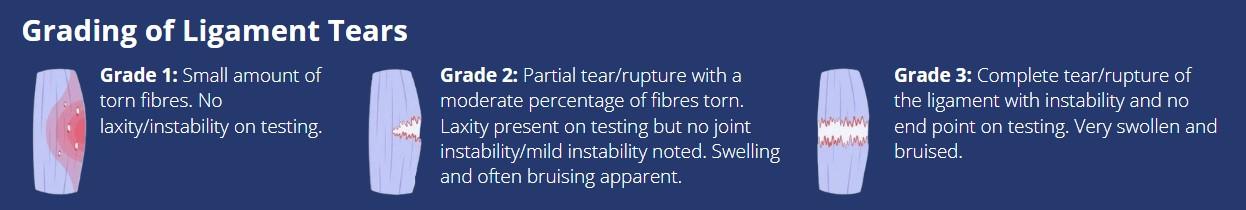 Grading of Ligament Tears